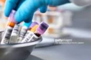 Sospensione servizio prelievi